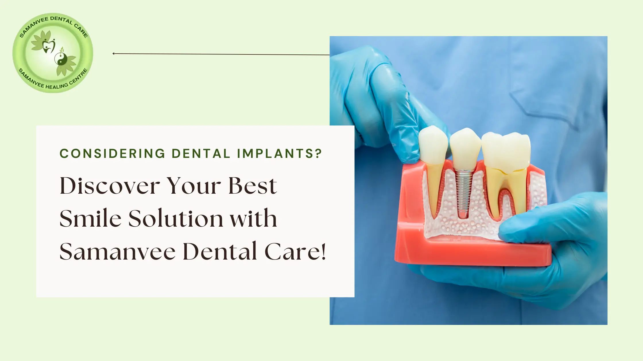 Considering Dental Implants Near Me? Here’s What You Should Know
