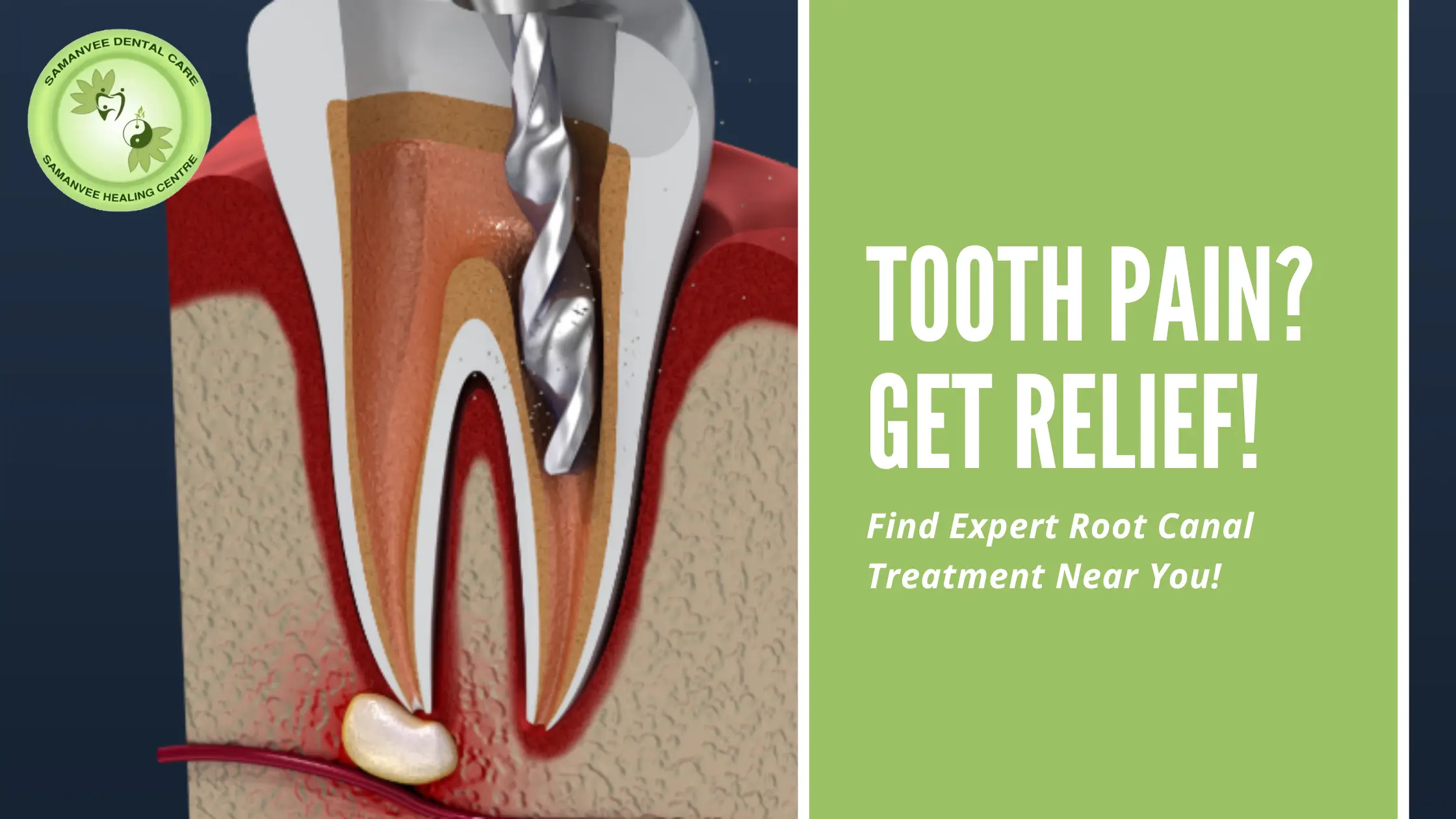 Say Goodbye to Tooth Pain: Finding an RCT Specialist or Root Canal Treatment Near Me